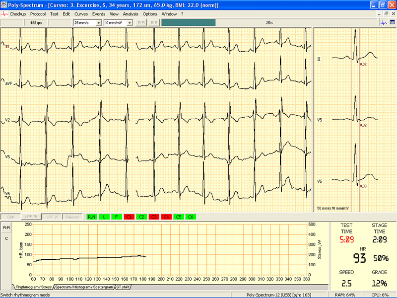 Soft analiza ECG teste de efort POLY-SPECTRUM-ERGO