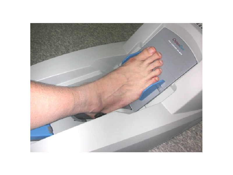 Osteodensitometru SONOST-3000 