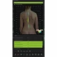 Examinare făcută cu Dispozitiv pentru analiza coloanei vertebrale SPINE 3D cu platforma 