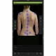 Examinare făcută cu Dispozitiv pentru analiza coloanei vertebrale SPINE 3D fara platforma 
