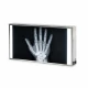 Negatoscop dublu, standard, 80x43cm 