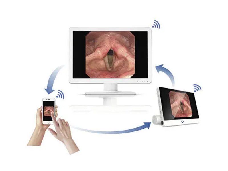 Videonazofaringoscop flexibil EF28 cu monitor VS-50-B 