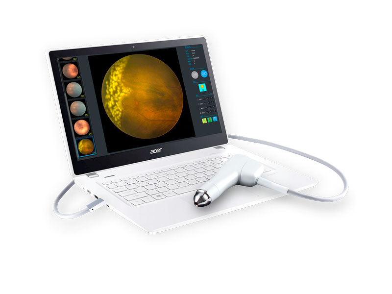 Fundus camera ROP SW-8000 SUOER 