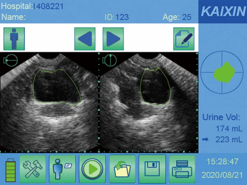 Scanner vezica urinara BVT01 