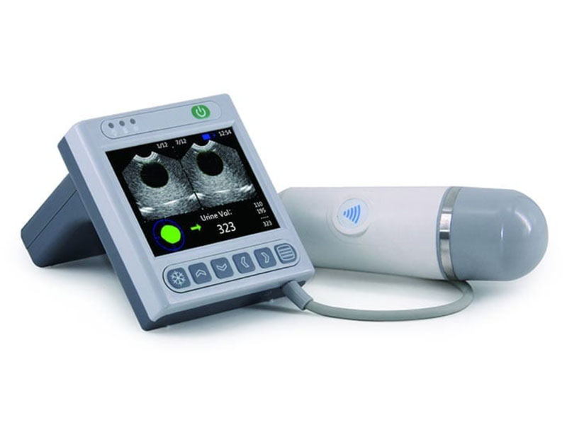 Scanner vezica urinara BVT02 