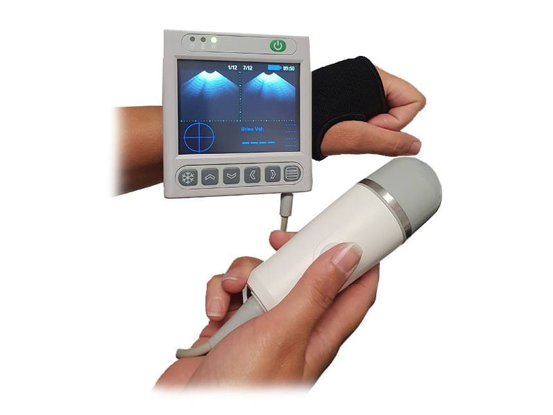 Scanner vezica urinara BVT02 