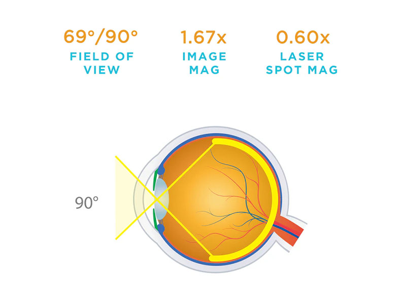 Lentila 40D VOLK, indice negru 