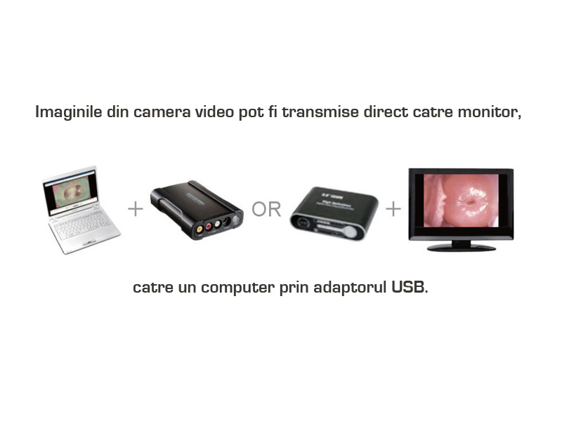 Colposcop AC-2311 HD 