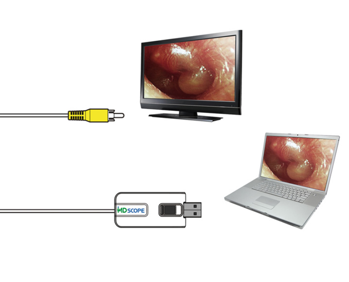 Video-otoscop MD SCOPE cu 3 sonde uz veterinar