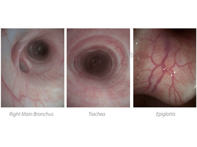 Videobronhoscop adult EB-5H20 