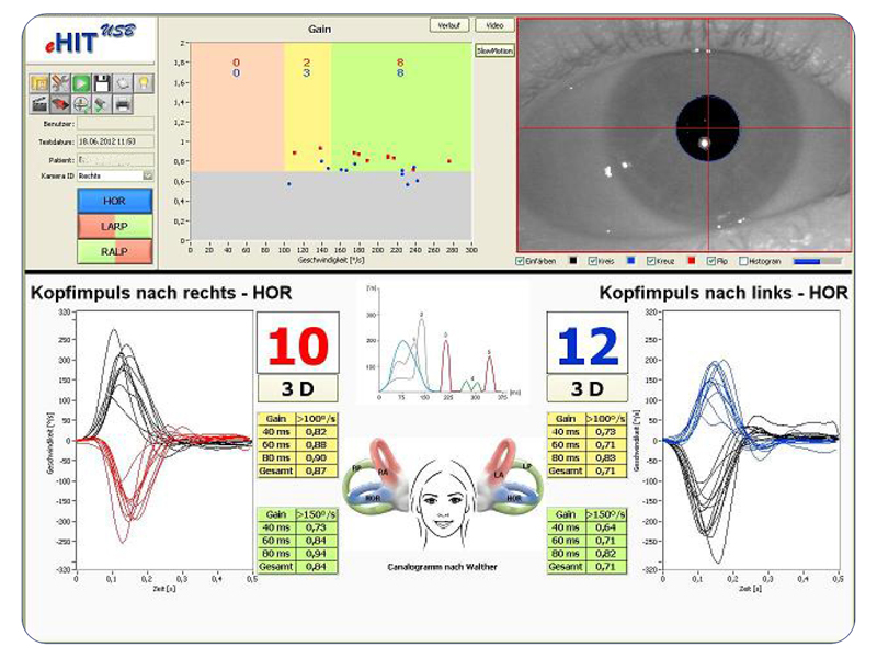 Sistem VNG+HIT (Videonistagmograf cu Head Impulse Test) 