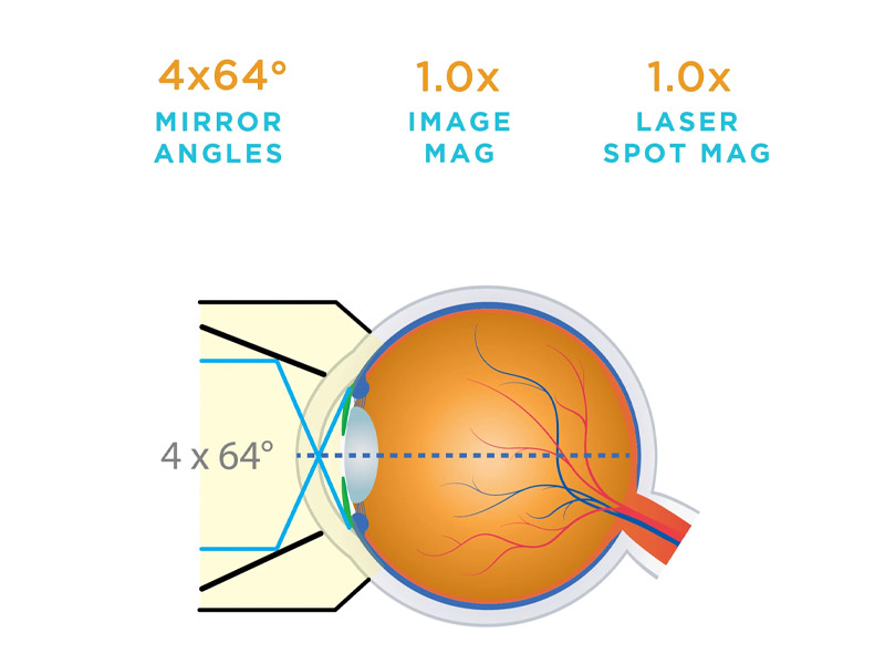 Lentila GONIO G-4 VOLK, fara flansa, inel mic 