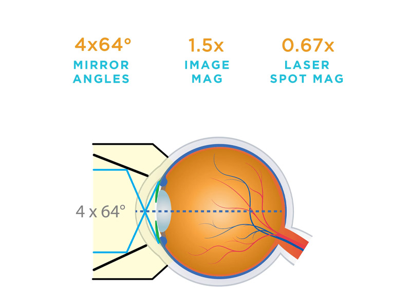 Lentila G-4 HIGH MAG GONIO VOLK, fara flansa, inel mic 